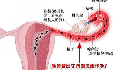 输卵管出问题.jpg