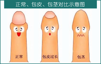 yyy.jpg