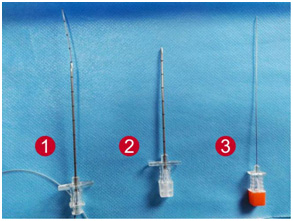 目前,国内剖宫产普遍使用的是 "腰硬联合麻醉",使用粗针套细针,先