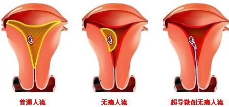 人流技术.jpg