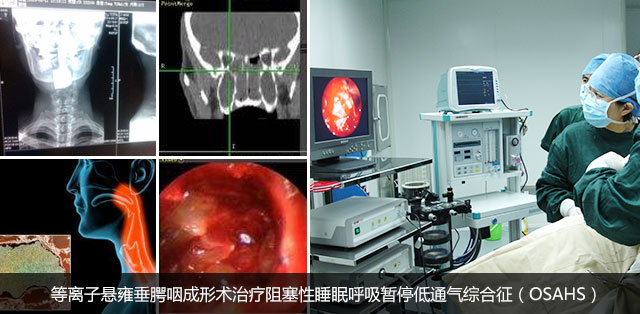 h贵州省二医耳鼻喉科鼾症检查.png