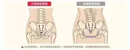 盆骨图.jpg