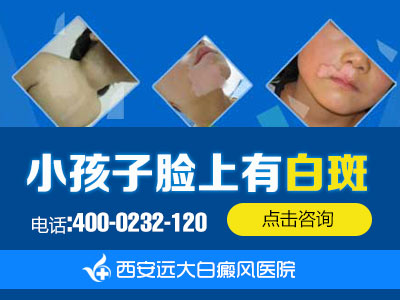小孩子脸上有白斑.jpg
