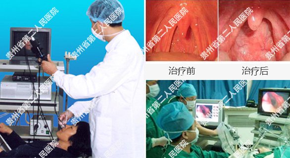 y贵州省第二人民医院耳鼻喉科咽喉炎手术对比.jpg