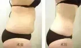 术前术后.jpg