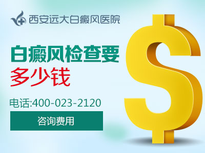 白癜风检查要多少钱-副本.jpg