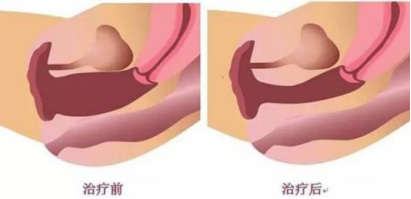 紧缩.jpg