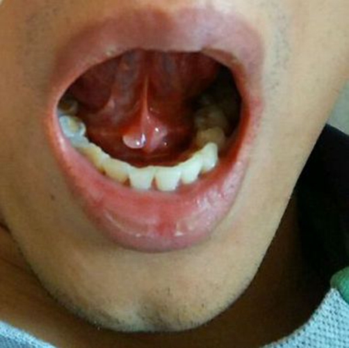 舌下腺小管图片