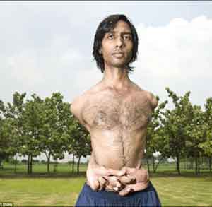 印度“橡胶人”：胳膊能够绕到身体后面！