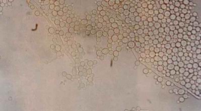 白色念珠菌图片