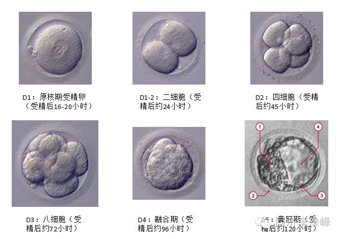 第3天的稱為卵裂胚,第5天(也有時為第6天)的稱為囊胚,當天移植的稱為