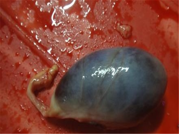 猪胆汁的功效与作用