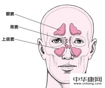 鼻窦炎有哪些症状图解图片