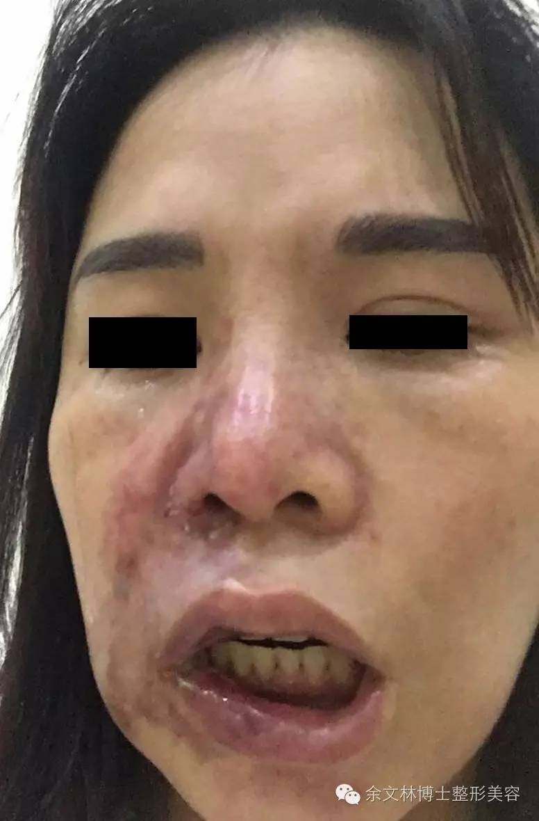 姑且不论有没有医师资格,我只讲有没有相关医学知识,是否明确面部血管