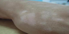 QQ截图20170703102407.png