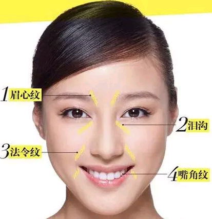 法令纹,一条线让你少女变阿婆!
