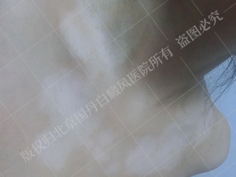 图片7.png