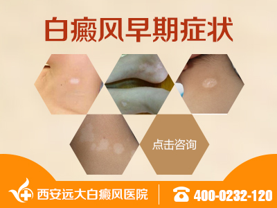 白癜风早期症状.jpg