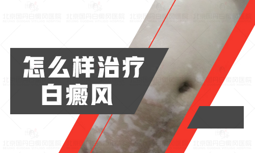 wpsA98_tmp.png