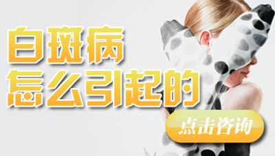 1-14091G02H2342.png