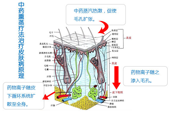 中药熏蒸疗法_特色诊疗_重庆迪邦皮肤病医院_中华康网