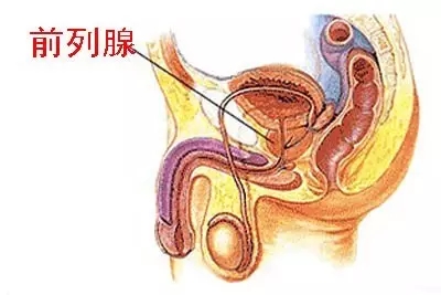 前列腺增生病人图片