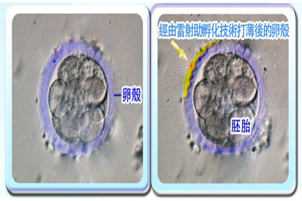 辅助孵化_副本.jpg